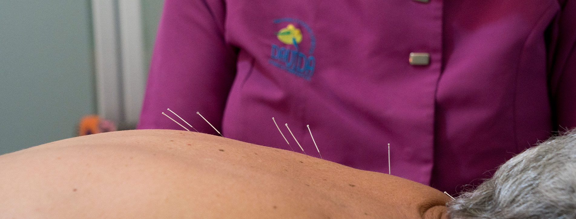 Neuromodulación en Segovia